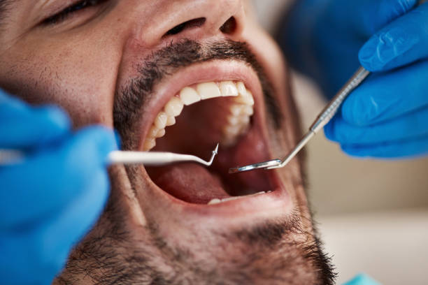 Emergency Dentist for Kids in LA